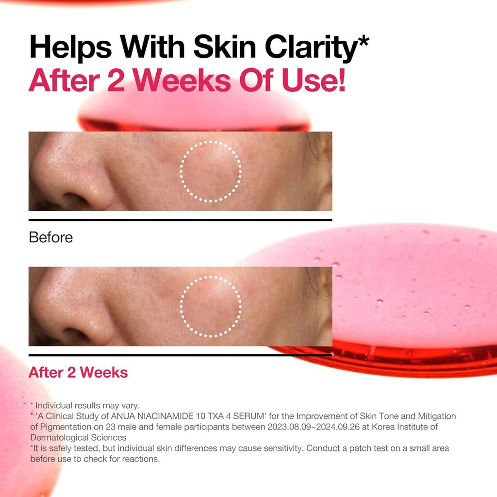 Anua Niacinamide 10% + TXA 4% Serum