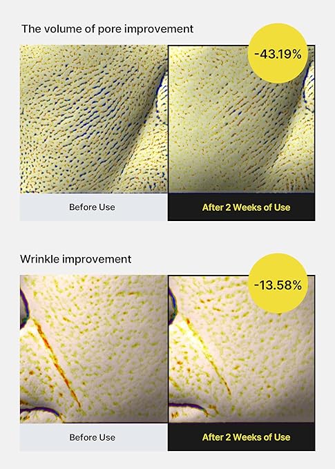 Celimax The Vita-A Retinol Shot Tightening Serum with Pure Vitamin-A, 0.1% Retinol, 9 Peptides & Panthenol for Pore Minimizing, Wrinkles & Fine Lines, Firmer Skin, Anti-Aging, Skin Smoothing (30ml)