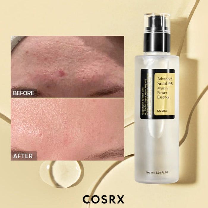 COSRX Advanced Snail 96 Mucin Power Essence Serum (100ml)